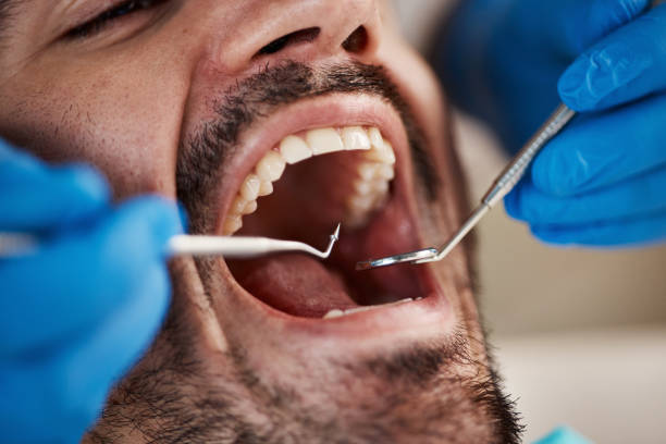 Best Emergency Dental Care for Broken or Chipped Teeth in Loxley, AL