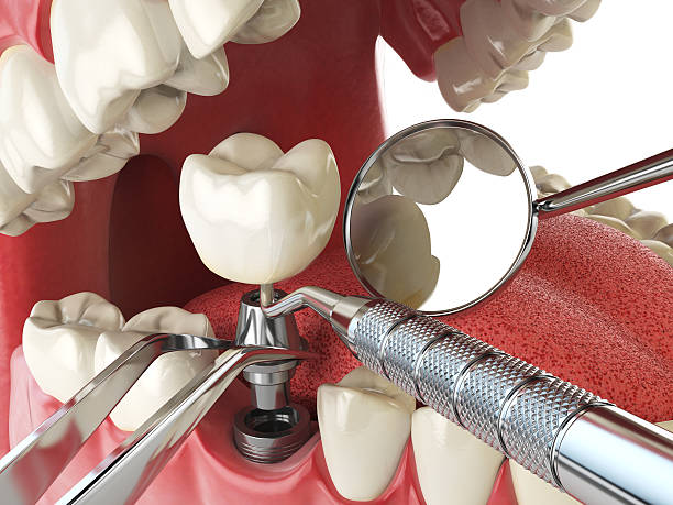 Best Cosmetic Emergency Dentistry in Loxley, AL
